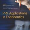 PRF Applications in Endodontics